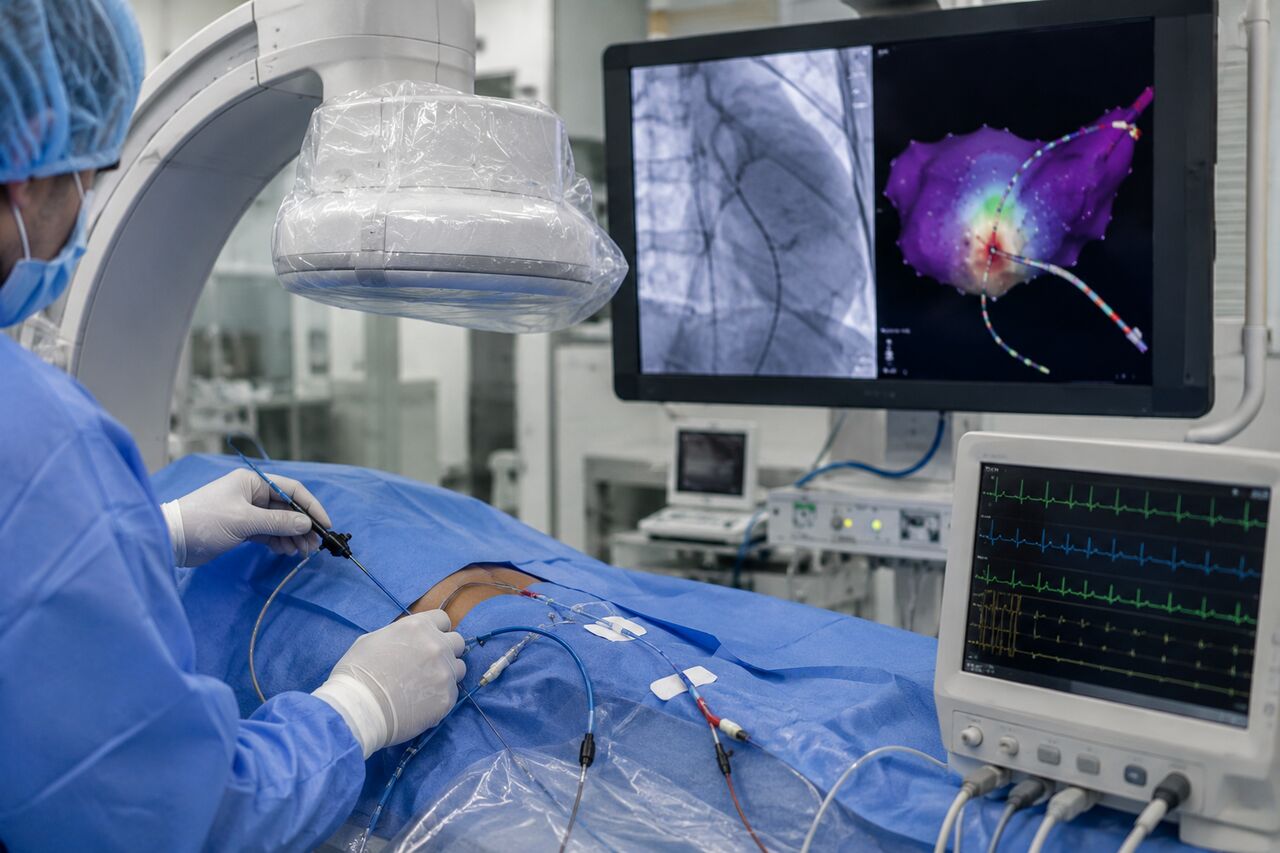 Dubai, Health, Trusted SVT Ablation Dubai For Abnormal Heart Rhythms