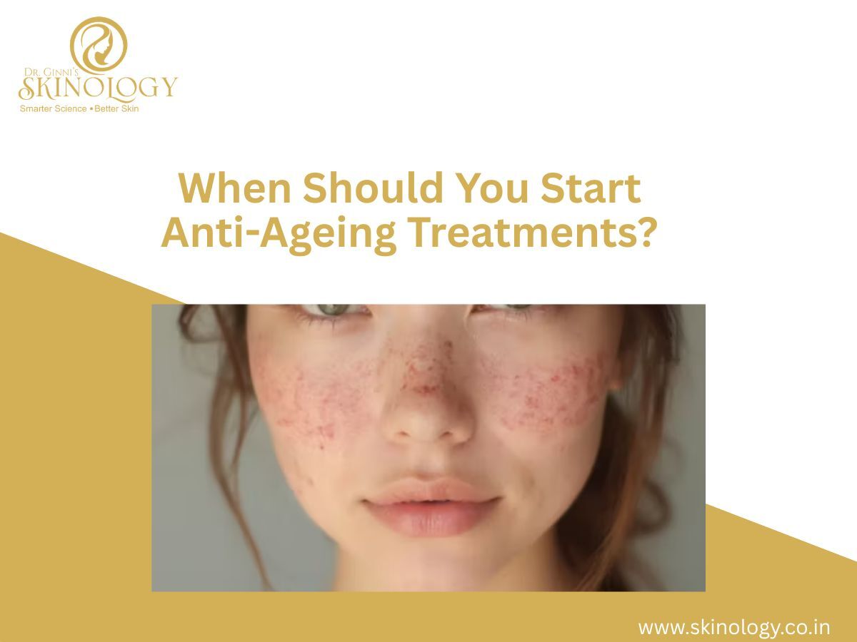 Indore, Health, When Should You Start Anti-Ageing Treatments?