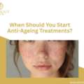 When Should You Start Anti-Ageing Treatments?