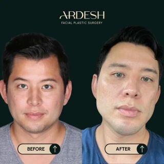 Washington DC, Health, Ardesh Facial Plastic Surgery