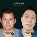 Ardesh Facial Plastic Surgery