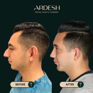 Washington DC, Health, Ardesh Facial Plastic Surgery