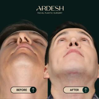 Washington DC, Health, Ardesh Facial Plastic Surgery