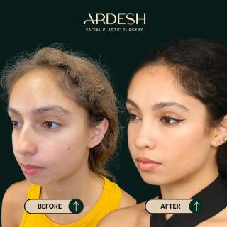 Washington DC, Health, Ardesh Facial Plastic Surgery
