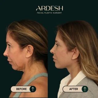 Washington DC, Health, Ardesh Facial Plastic Surgery