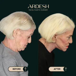Washington DC, Health, Ardesh Facial Plastic Surgery