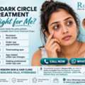 INR 3000,  Dark Circle Treatment Price Near Banjara Hills