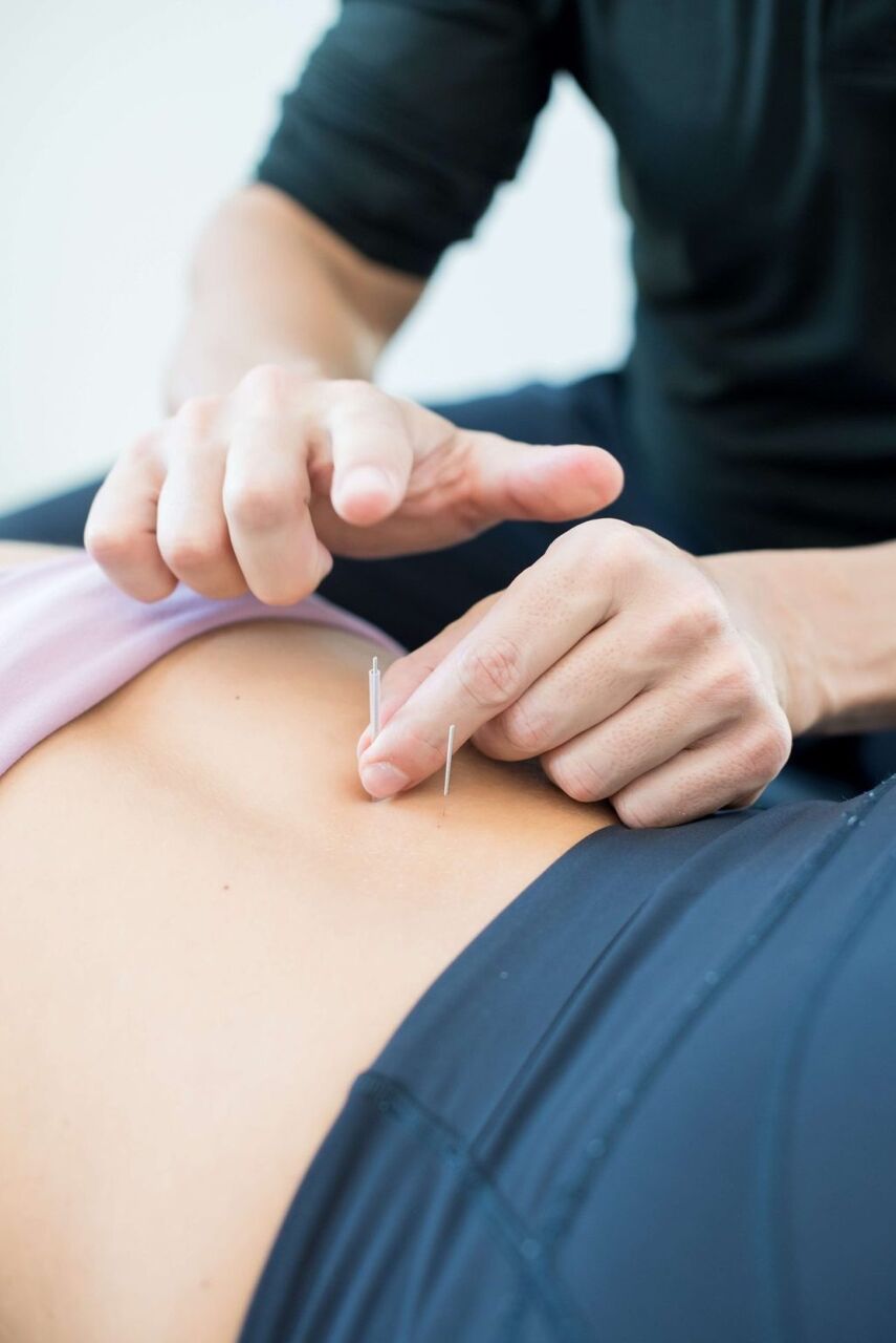 New York, Health, Dry Needling Hands-On Course For Chiropractors | Pulse Point Practice