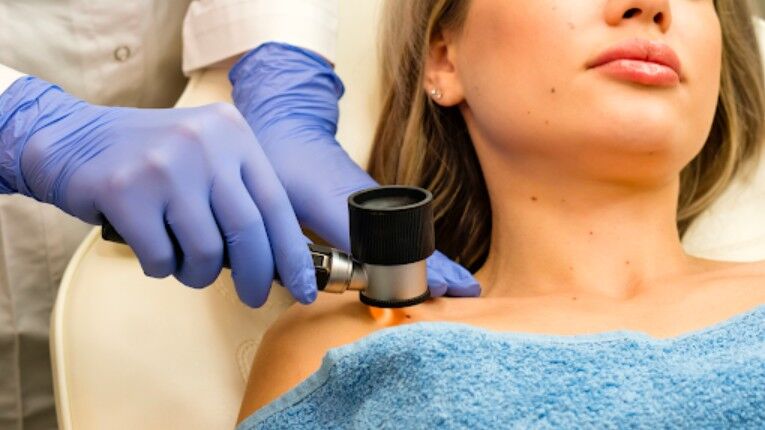 Sydney, Health, Skin Cancer Screening & Check