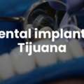 Dental Implants Tijuana Offers Natural-looking And Durable Teeth Replacements