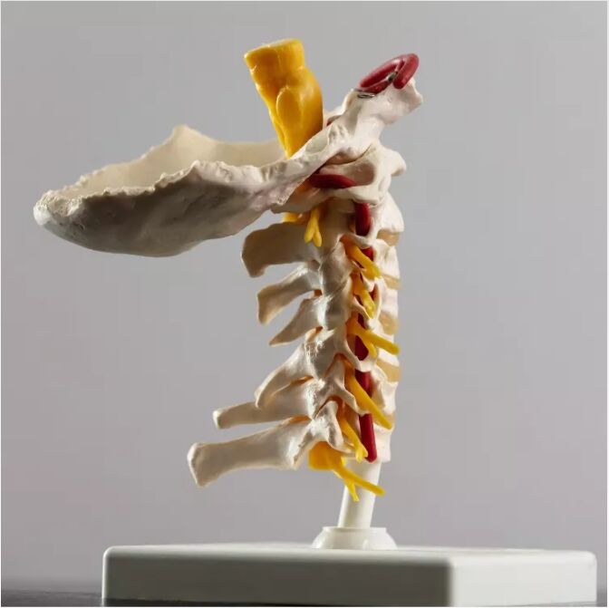 Sydney, Health, Cervical Spinal Canal Stenosis & Myelopathy
