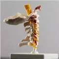 Cervical Spinal Canal Stenosis & Myelopathy