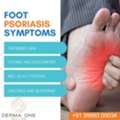 Signs Of Foot Psoriasis And Treatment- Dr Sushree Sovana
