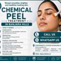 INR 2000,  Chemical Peel Treatment In Banjara Hills, Hyderabad