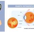 Specialized Diabetic Retinopathy Evaluation And Treatment