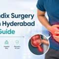 Appendix Surgery Cost In Hyderabad: Quick Guide