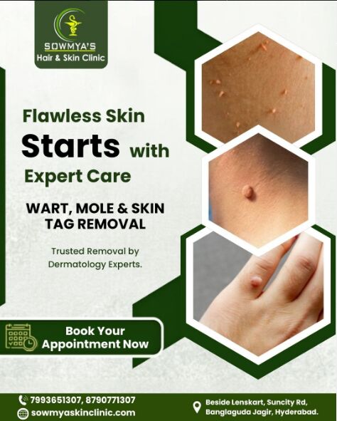 Hyderabad, Health, Skin Doctor In Suncity, Hyderabad &ndash; Expert Dermatology Care