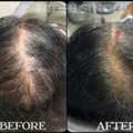 The Aesthetic House &ndash; Personalized Hair Care In Rajarhat