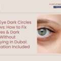 Under-Eye Dark Circles & Hollows: How To Fix Tired Eyes & Dark Circles Without Overpaying
