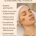 Benefits Of Chemical Peels- Derma One - Visakhpatnam
