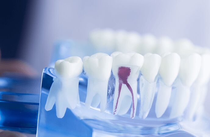 Melbourne, Farm & Garden, How Root Canal Treatment Relieves Tooth Pain And Saves Teeth