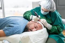 Chandigarh, Health, Advanced FUE Hair Transplant In Chandigarh For Fuller-Looking Hair