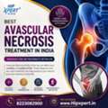 Best Avascular Necrosis Treatment In India - Hip Xpert