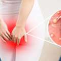 Ayurvedic Care For Piles And Fistula With Expert Guidance