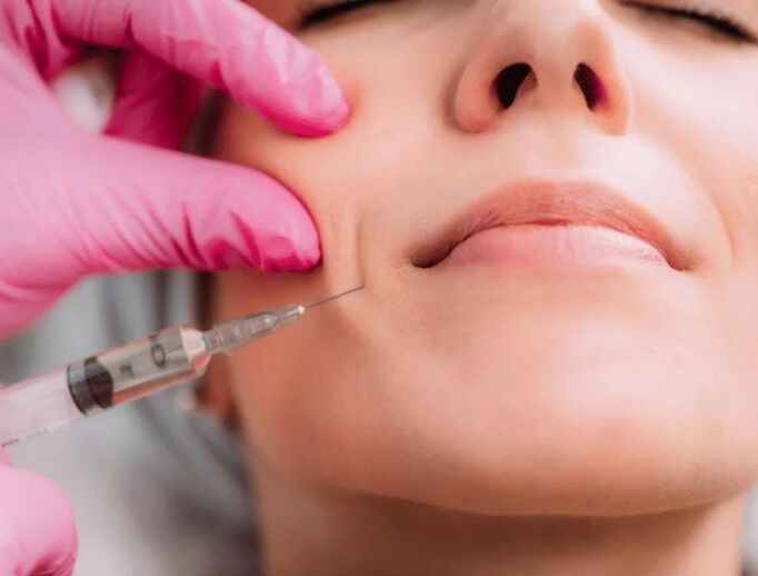 Cape Town, Beautician, Enhance Your Look With Dermal Fillers
