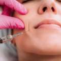Enhance Your Look With Dermal Fillers