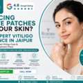 INR 5000,  Vitiligo Treatment Near Tilak Nagar Jaipur For White Patches On Skin