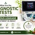 What Are The Diagnostic Tests For Venous Leakage Treatment In India?