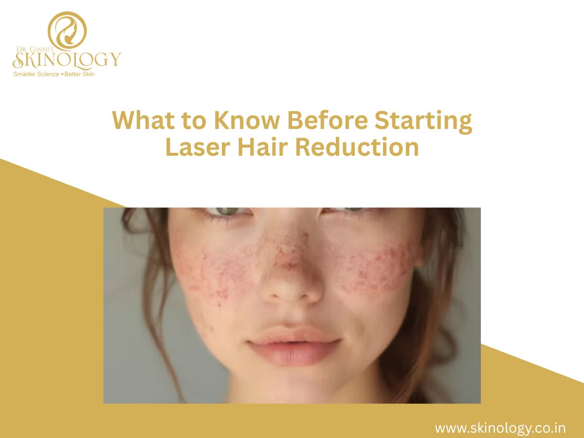 Indore, Health, What To Know Before Starting Laser Hair Reduction