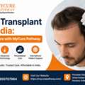 Hair Transplant In India &ndash; Expert Care With MyCure Pathway