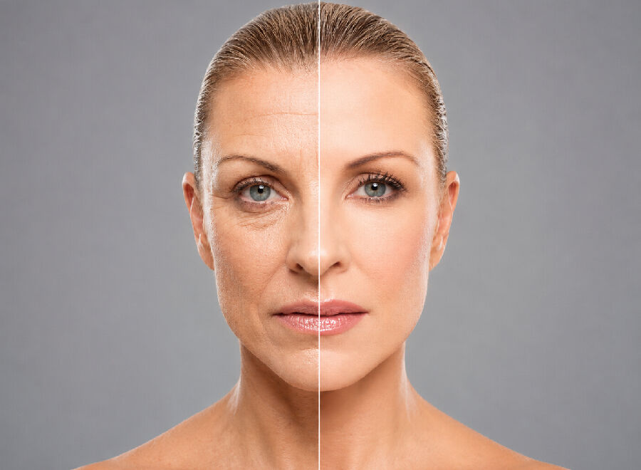 Mumbai, Health, Best Face Rejuvenation Surgery In Mumbai By Expert Plastic Surgeons