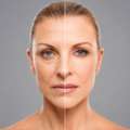 Best Face Rejuvenation Surgery In Mumbai By Expert Plastic Surgeons