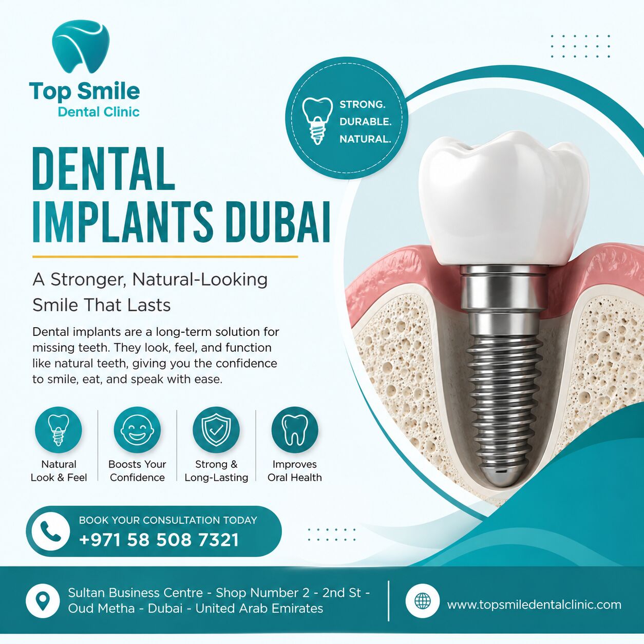 Dubai, Dental, Dental Implants Dubai &ndash; Restore Your Smile With Confidence