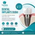 Dental Implants Dubai &ndash; Restore Your Smile With Confidence