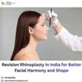 Revision Rhinoplasty In India For Better Facial Harmony And Shape