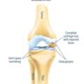Arthritis Knee Treatment Options Worth Understanding First