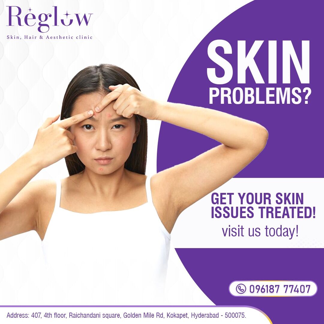 Hyderabad, Health, Best Dermatologist In Kokapet | Reglow Skin Clinic