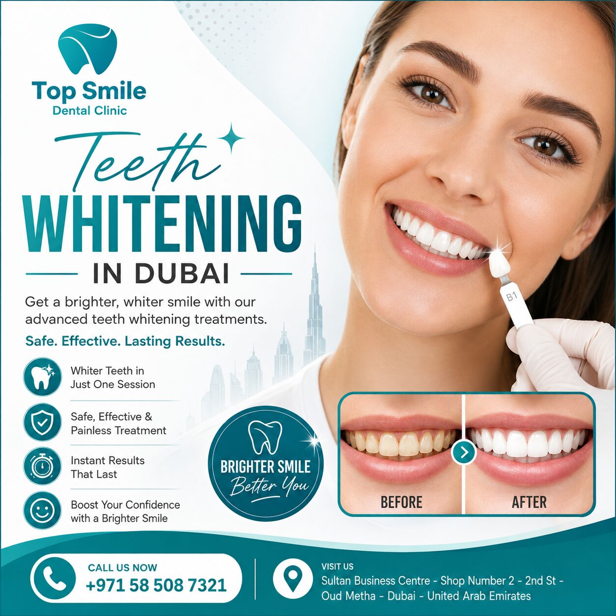 Dubai, Dental, Teeth Whitening In Dubai: A Complete Guide To A Brighter, More Confident Smile