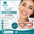 Teeth Whitening In Dubai: A Complete Guide To A Brighter, More Confident Smile