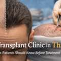 Professional Hair Transplant Clinic In Thane &ndash; DNA Royal.