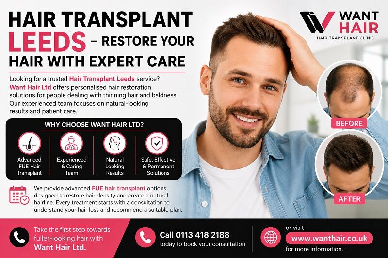 London, Beautician, Hair Transplant Leeds - Restore Your Hair With Expert Care