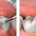 Tooth Extraction Clinic In Al Nahda - AFFORD Clinic In Al Nahda Dubai
