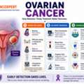 Ovarian Cancer Specialist In Mumbai | Dr. Sanket Shah
