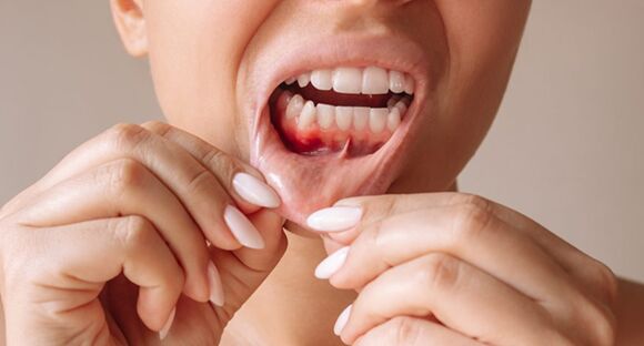 Sydney, Dental, Restore Healthy Gums With Treatment In Greensborough