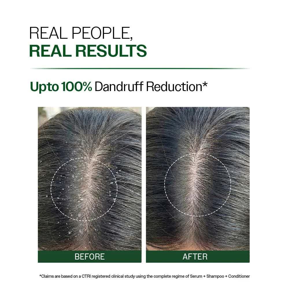 Gurugram, Health & Beauty Items, INR 460,  Best Anti Dandruff Shampoo With Salicylic Acid For Scalp Care