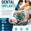 How Dental Implants Procedure Work?